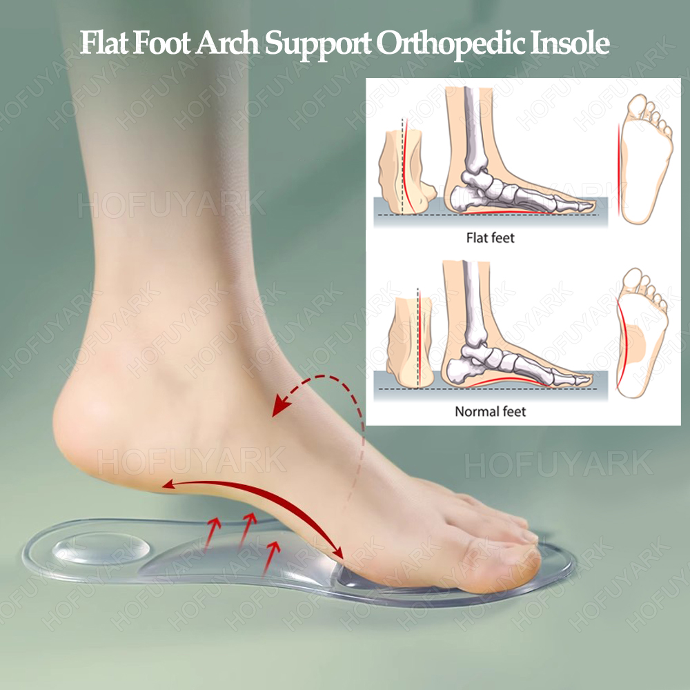 Silicone Gel Insoles Orthopedi - مراجعة Women'S Shoes High Arch Support وسعره